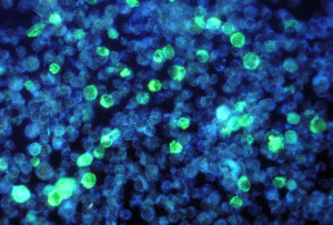 640px-Leukemia_cells_that_contain_Epstein_Barrvirus_using_a_FA_staining_technique_PHIL_2984_lores