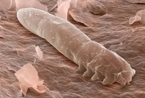 Eyelash-mites-under-a-microscope